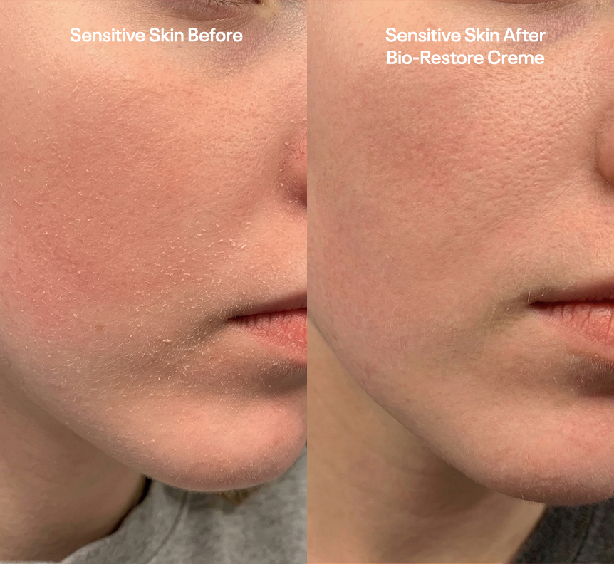 Skin comfort care